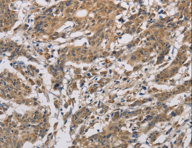 Polyclonal Rabbit anti-Human CYCS / Cytochrome c Antibody (IHC, WB)