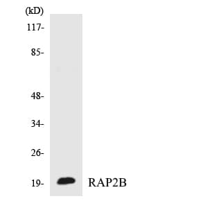 Polyclonal Rabbit anti-Human RAP2B Antibody (aa83-132, WB)