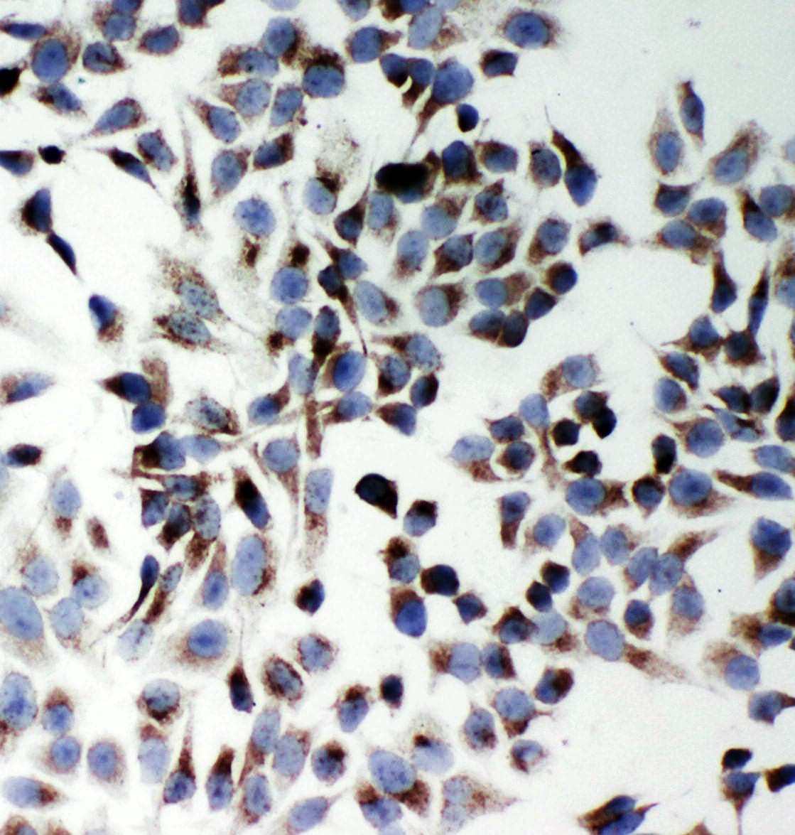 SQSTM1 Antibody (aa91-110)