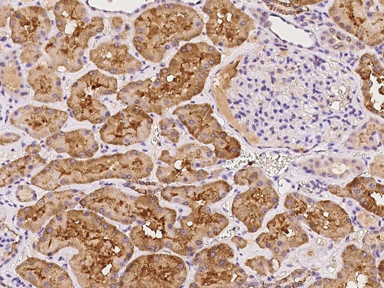 Polyclonal Rabbit anti-Human MNS1 Antibody (IHC)