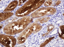Monoclonal Mouse anti-Human BBOX1 / BBOX Antibody (clone OTI1D6, IHC, WB)