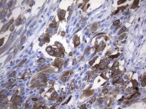 MLANA / Melan-A Antibody (aa48-118, clone UMAB217, Carrier-free)