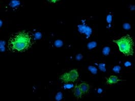 RPN1 / Ribophorin I Antibody (clone OTI6A9)