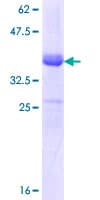 Human SLC12A2 / NKCC1 Protein (Recombinant GST, N-terminus)