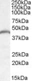 IHC-plus™ PNPLA3 / Adiponutrin Antibody (aa186-197)