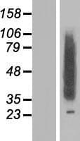 CLN8 Protein (Over-Expression Lysate Myc-DDK (Flag))