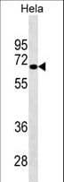 Monoclonal Mouse anti-Human SNARK / NUAK2 Antibody (WB)
