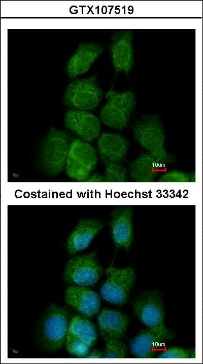IHC-plus™ MAPK15 / ERK7 Antibody