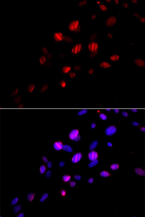 RAD18 Antibody