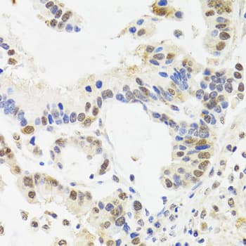 SUZ12 Antibody