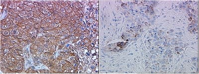 ERBB2 / HER2 Antibody (aa182-194)