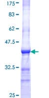 Human IQGAP3 Protein (Recombinant GST, N-terminus)