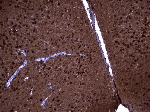UCHL1 / PGP9.5 Antibody (clone UMAB244)