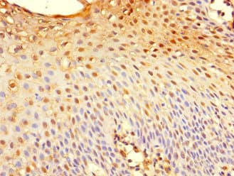 TSC22D3 / GILZ Antibody