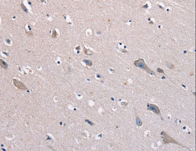 KCNQ5 Antibody