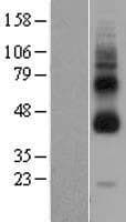 GPR119 Protein (Over-Expression Lysate Myc-DDK (Flag))