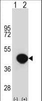 Polyclonal Rabbit anti-Human BGN / Biglycan Antibody (aa148-176, IHC, WB)