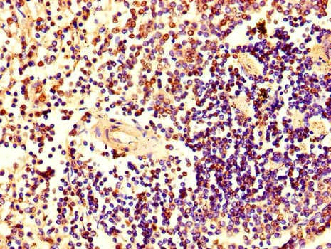 HRAS / H-Ras Antibody