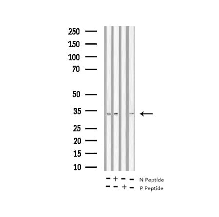 RPS6 / Ribosomal Protein S6 Antibody (phospho-Ser235)