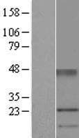 UPK1A / Uroplakin 1A Protein (Over-Expression Lysate Myc-DDK (Flag))