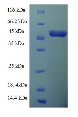 C. elegans R107.2 Protein (Recombinant His-SUMO)