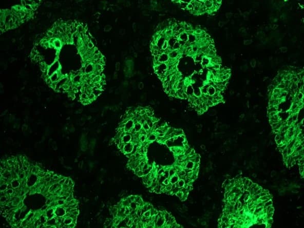 IHC-plus™ KRT8 / CK8 / Cytokeratin 8 Antibody (clone M20)