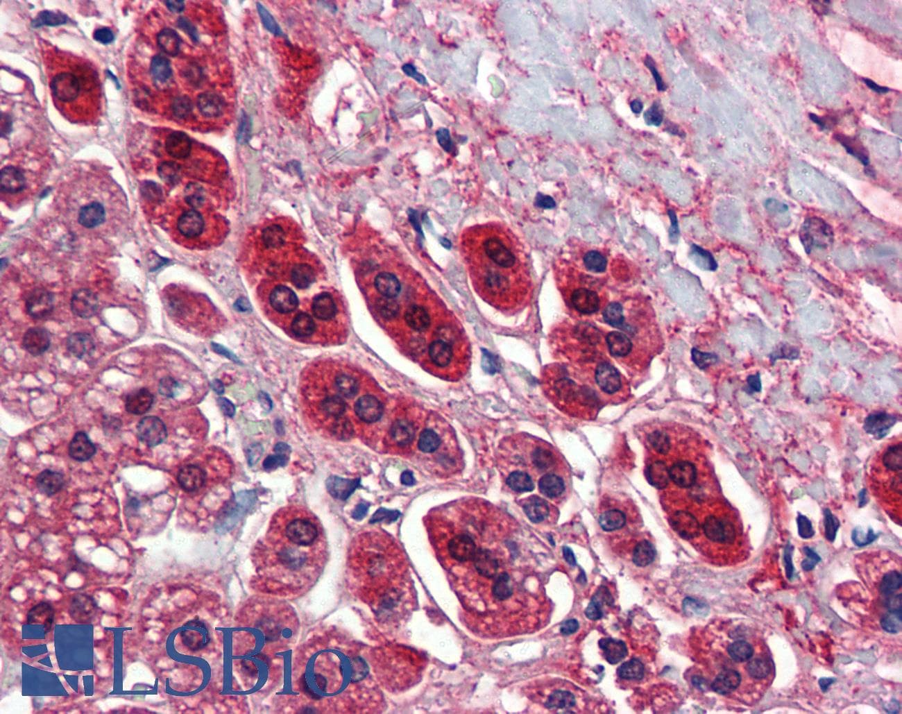 TCF21 / Epicardin Antibody (aa42-91)