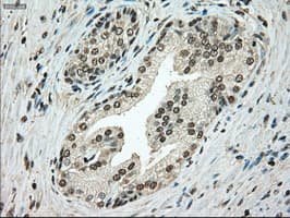 TYRO3 Antibody (clone OTI4C8)