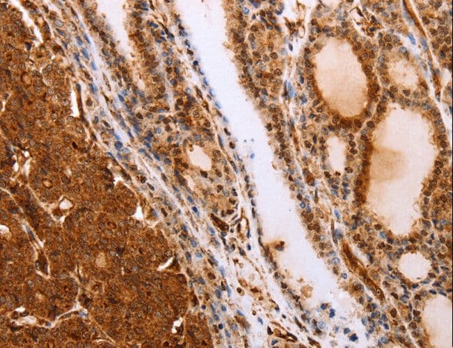 Polyclonal Rabbit anti-Human SLC9A3R2 / SIP1 Antibody (IHC)