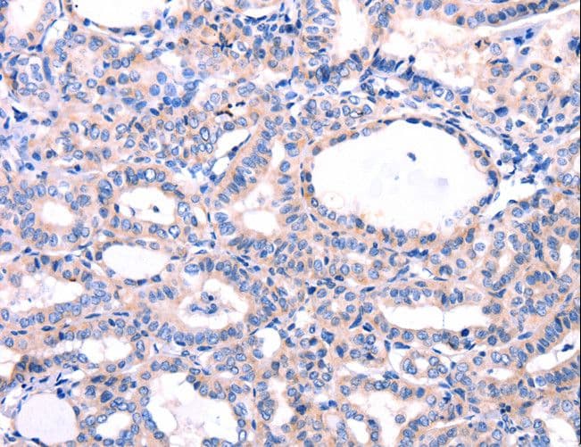 DUSP12 Antibody