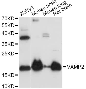 Polyclonal Rabbit anti-Human VAMP2 / VAMP-2 Antibody (IHC, WB)