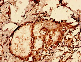GLE1 Antibody