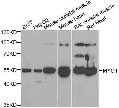 MYOT / Myotilin Antibody