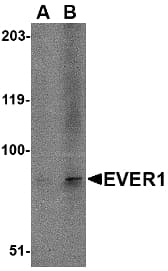 IHC-plus™ TMC6 Antibody