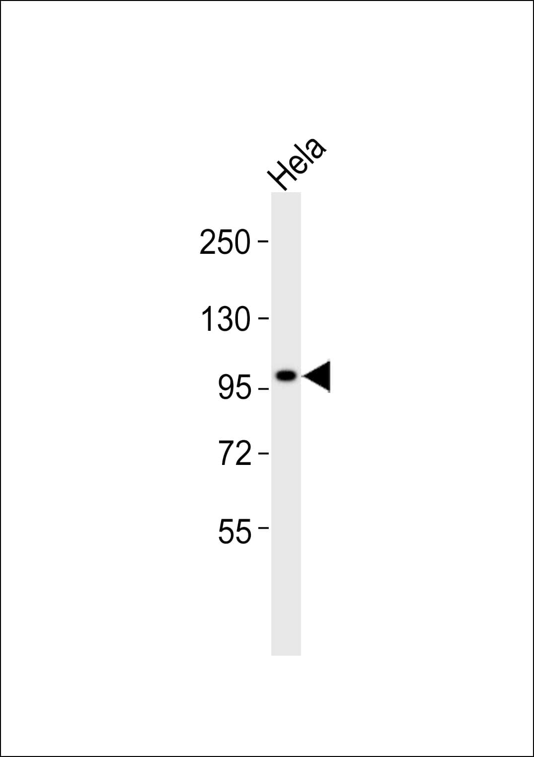 Kv10.1 / KCNH1 Antibody