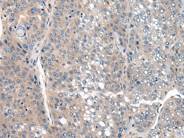 Polyclonal Rabbit anti-Human CLTCL1 / CHC22 Antibody (IHC)