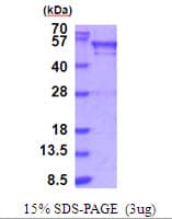Human BRD3 Protein (Recombinant His)