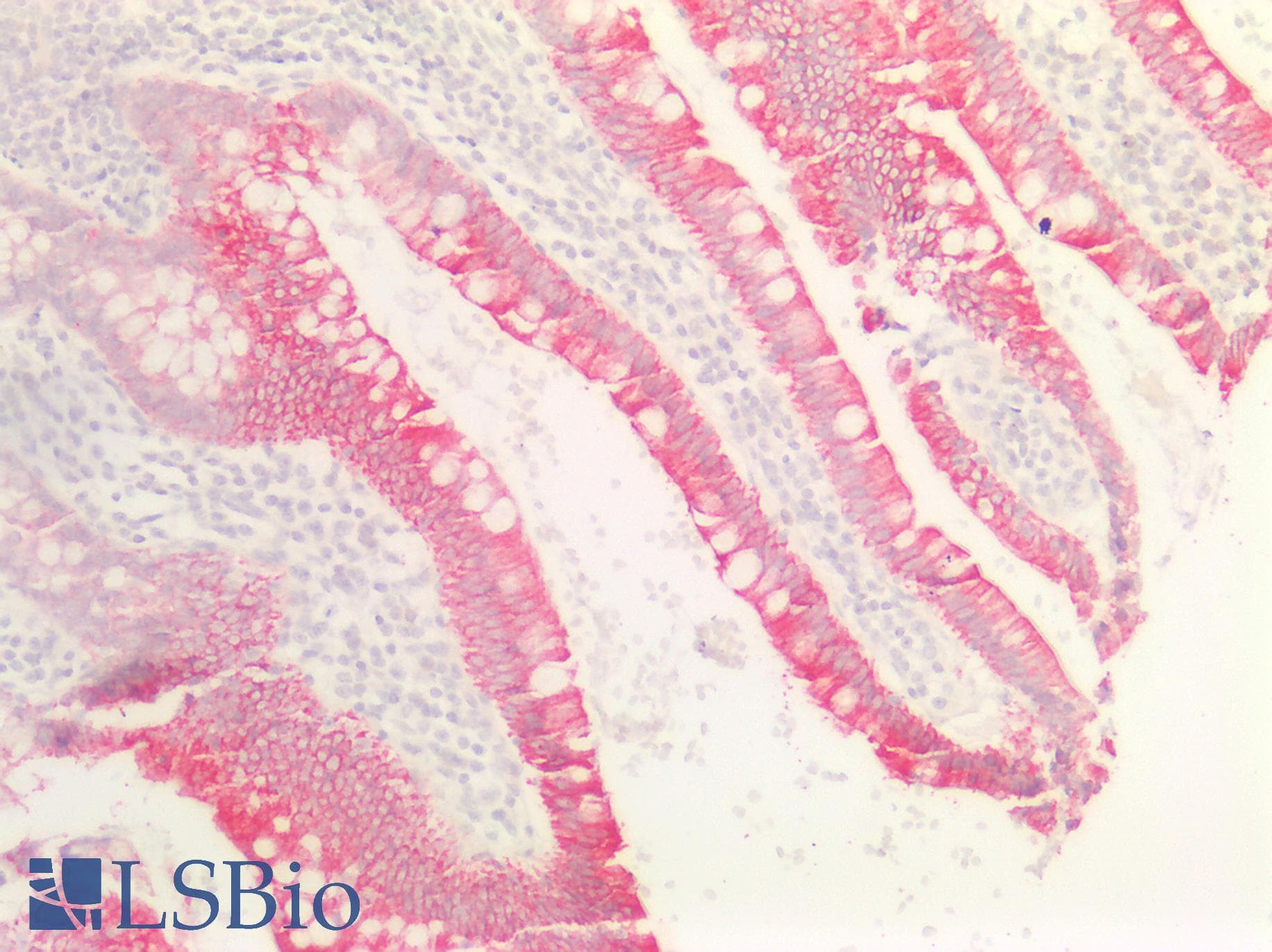 PathPlus™ Monoclonal Mouse anti-Human Cytokeratin AE1+AE3 Antibody (clone AE1 & AE3, IHC)