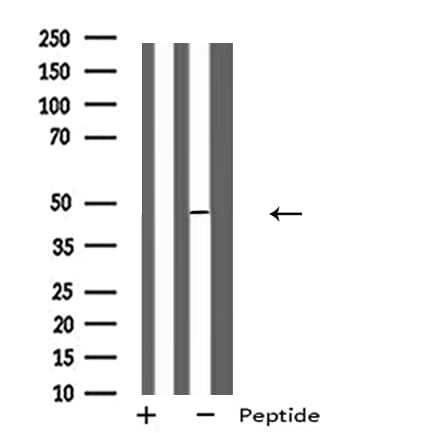 MLNR/GPR38/Motilin Receptor Antibody