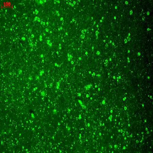 CACNA1C / Cav1.2 Antibody (aa1507-1733, clone S57-46, PerCP)