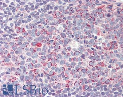 IHC-plus™ Polyclonal Rabbit anti-Human EFTU / TUFM Antibody (aa112-147, IHC, IF, WB)