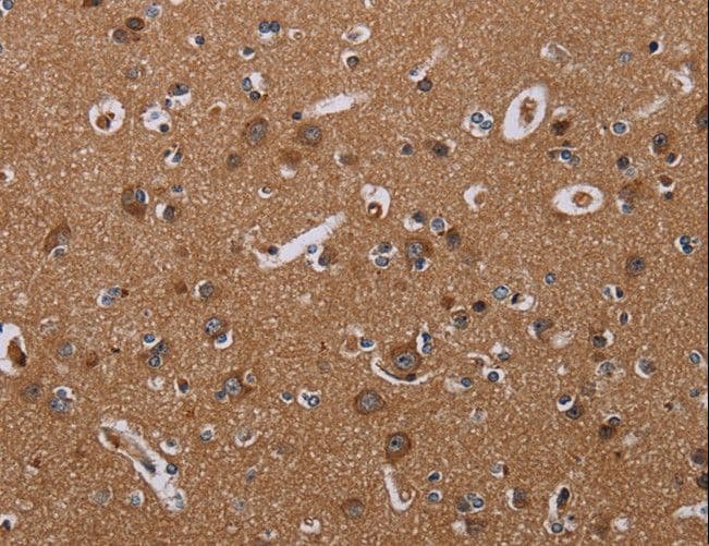 Polyclonal Rabbit anti-Human NOX3 Antibody (IHC)