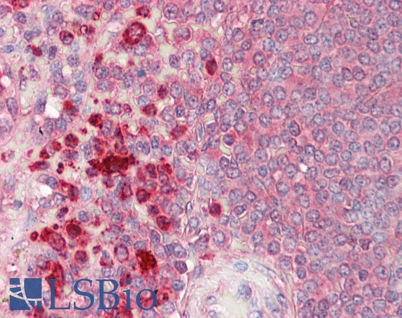 IHC-plus™ LYZ / Lysozyme Antibody