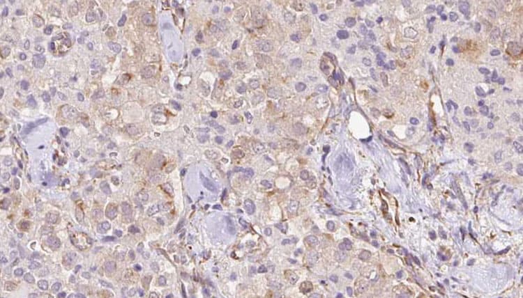 Polyclonal Rabbit anti-Human TMEM70 Antibody (IHC, WB)