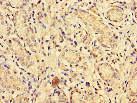 EPHA1 / EPH Receptor A1 Antibody