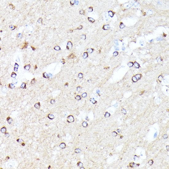 CCDC6 Antibody