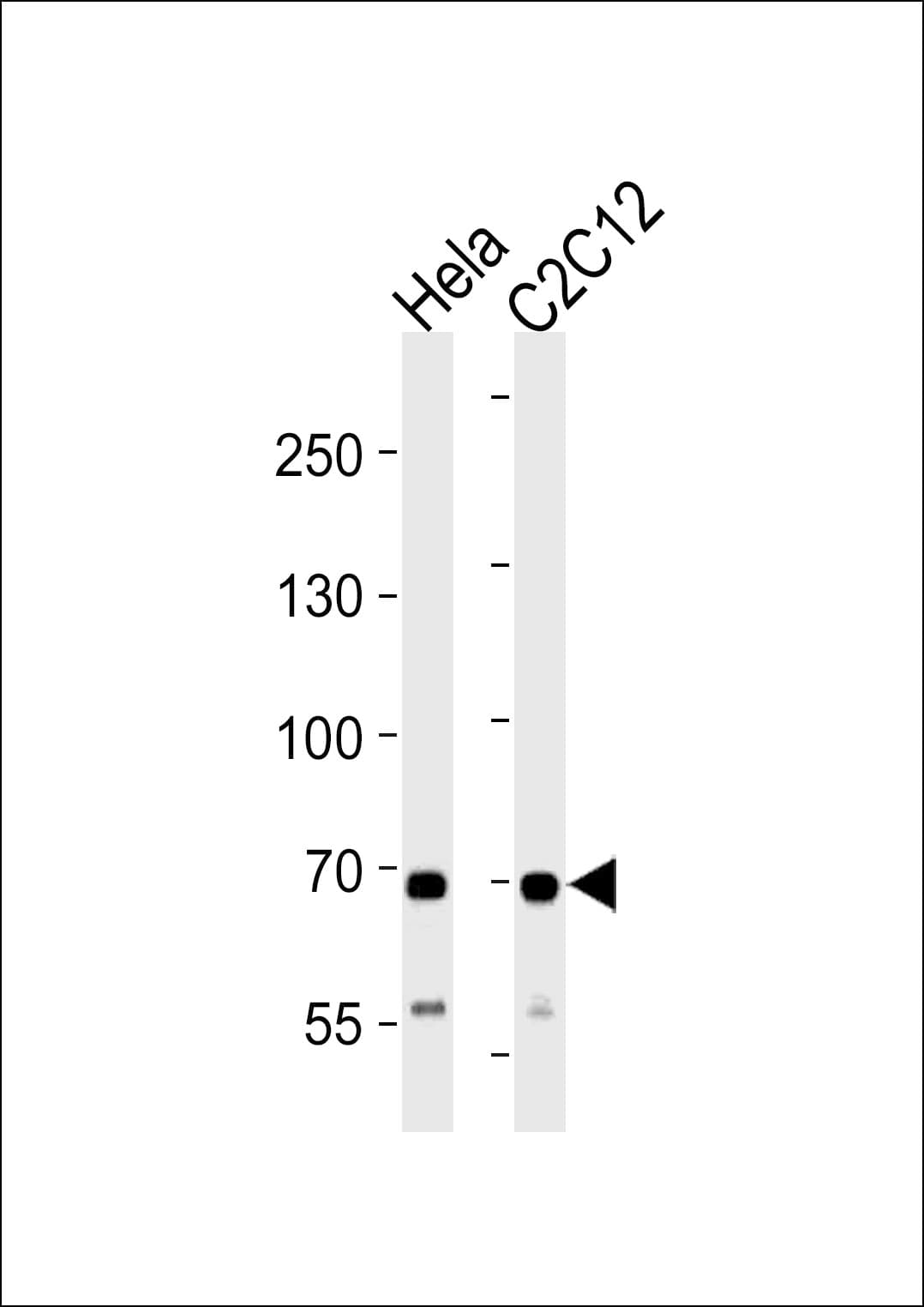 Polyclonal Rabbit anti-Human SDHA Antibody (aa577-605, WB)