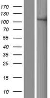 XYLT1 / XylT-I Protein (Over-Expression Lysate Myc-DDK (Flag))