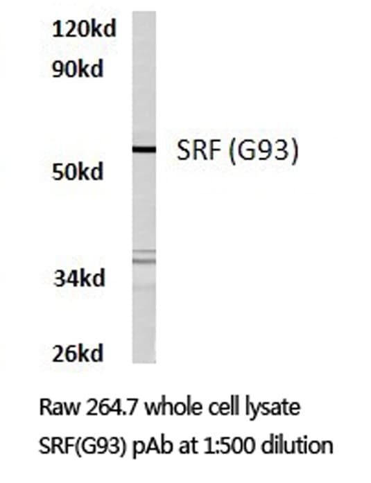 Polyclonal Rabbit anti-Human SRF / Serum Response Factor Antibody (Gly93, IHC, WB)