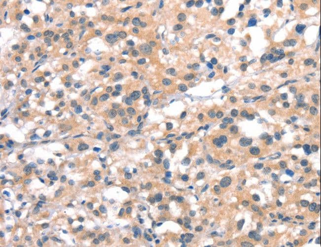 Polyclonal Rabbit anti-Human CYP2D6 Antibody (IHC)